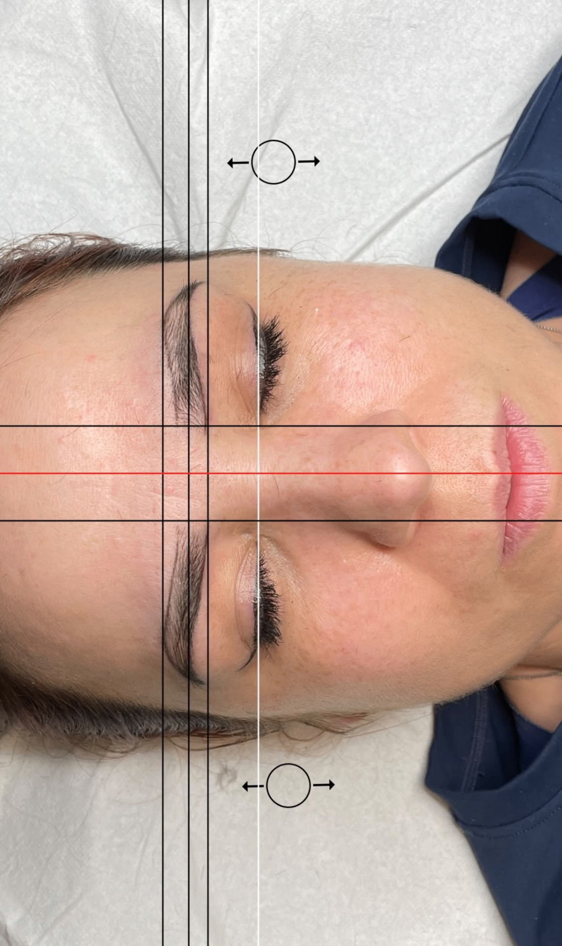 Facial symmetry study and Phi Golden Ratio measurement for brow design
