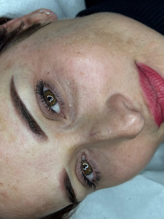 Before and after result of a brow treatment 4