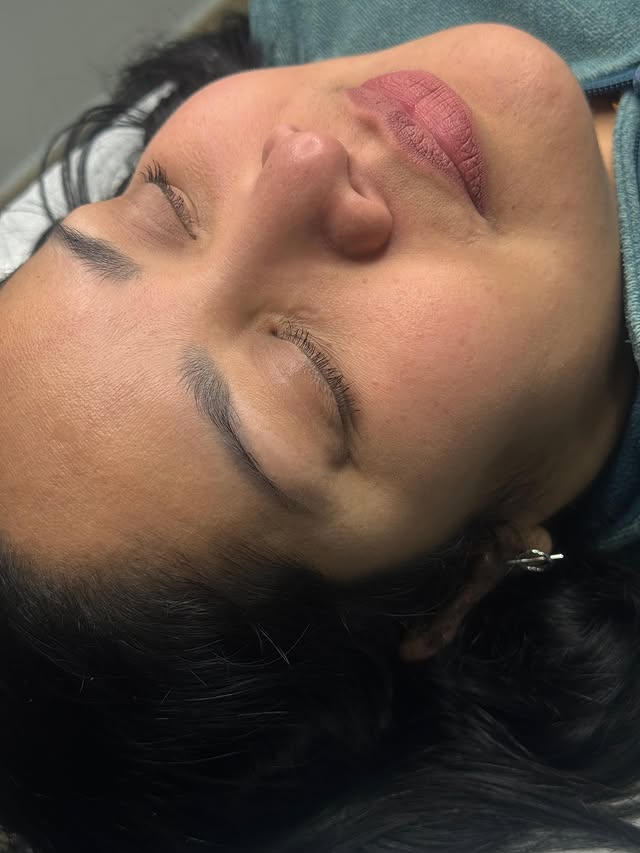 Before and after result of a brow treatment 1