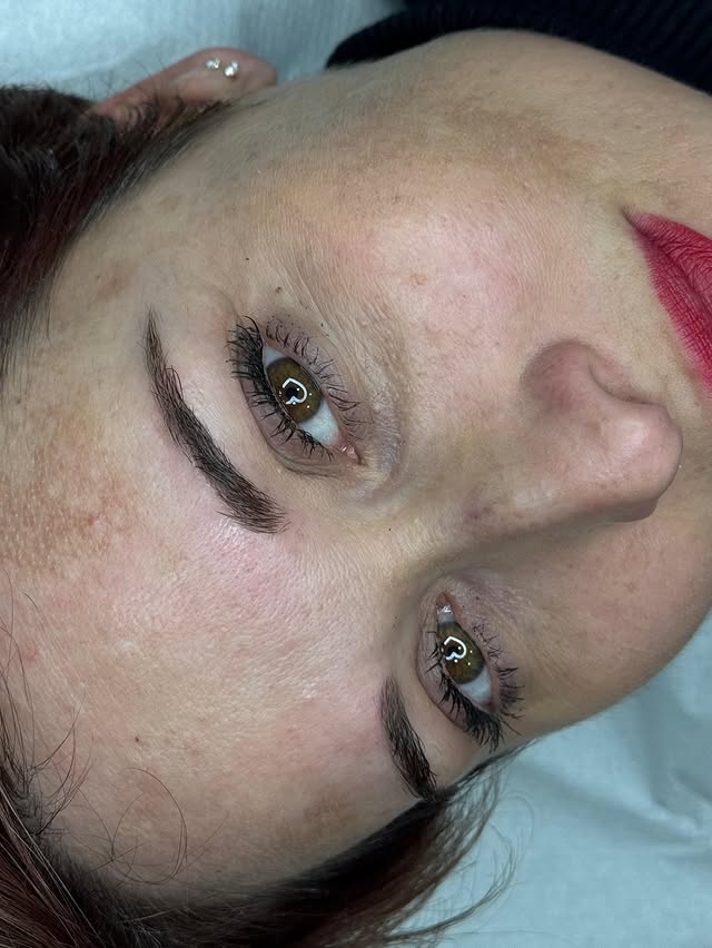 Before and after result of a brow treatment 3