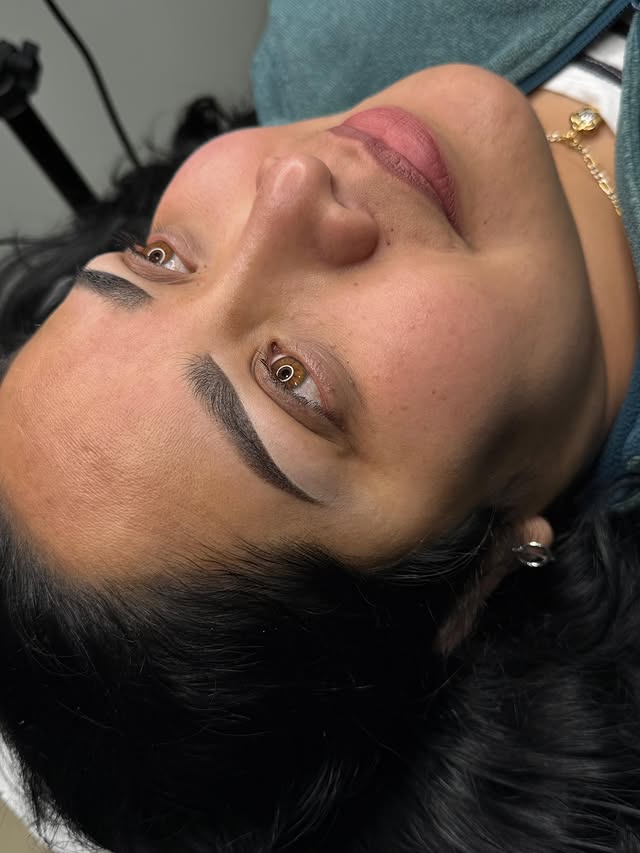 Before and after result of a brow treatment 2